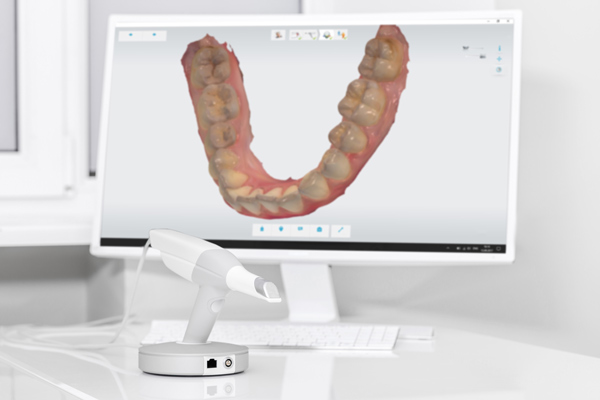 Intraoral 3D scanner and monitor in the dentist's office